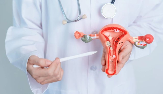ENDOMETRIOSIS